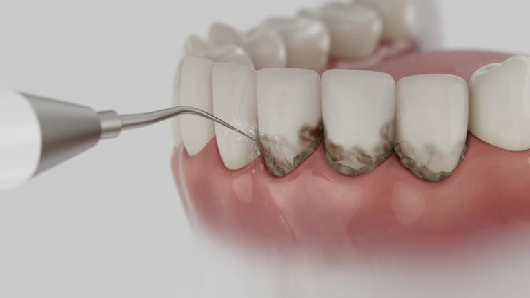 Trusted Root Canal Treatment service in Cole Camp, MO - Dentist Open Now
